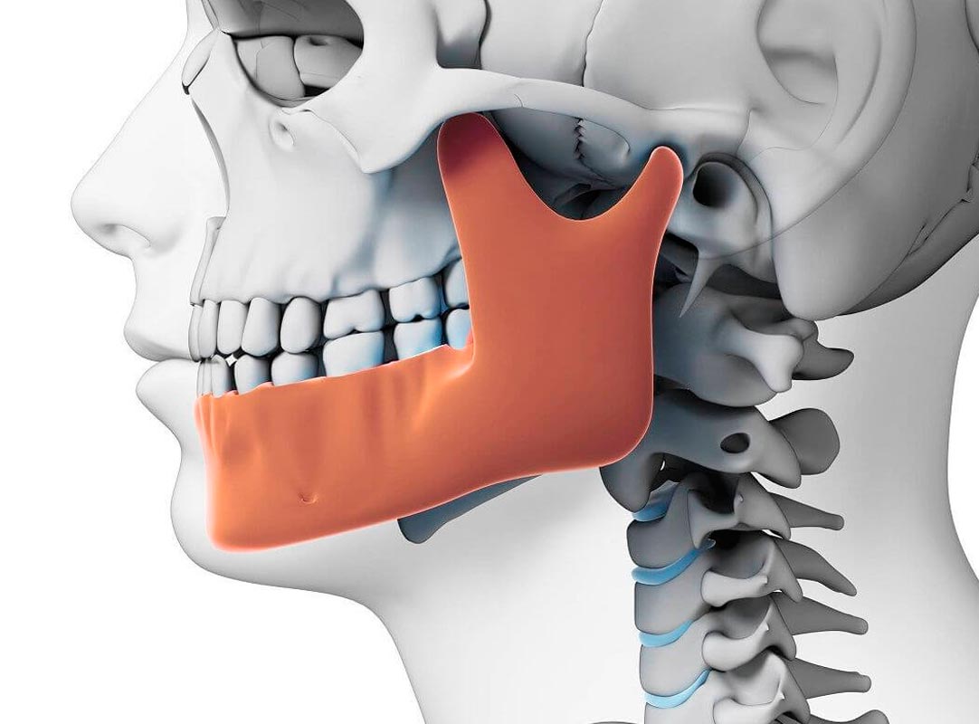 Tratamiento de disfunción cervico craneo mandibular y dolor fascial